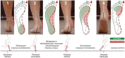 Наклонения на крака, тя е и как да се идентифицират