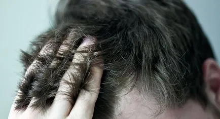 Iritatia scalpului ca o problemă comună