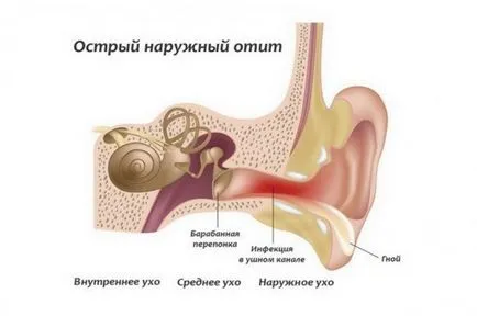 Пулсация в ухото на десния и левия фланг, причините за