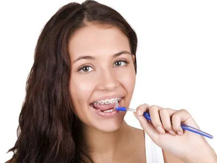 Rshiki за почистване на зъби и скоби, както е правото да използва, какви са