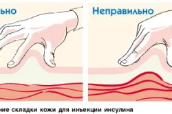 За автоматично инжектиране на инсулин избор, използване, предимства и недостатъци