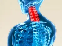 Spondiloza a coloanei vertebrale lombare, care este si modul de a trata boala
