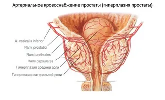 Statistica prostatita