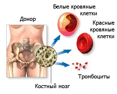 A csontvelő-átültetés, immuninfo