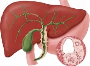 Colangita care este, tipuri, cauze, diagnostic și tratament