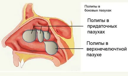 Procedura YAMIK pentru modul de a efectua sinusului, eficacitatea, indicații, contraindicații