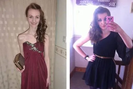 Анорексията преди и след (снимки и видео), на сцената на анорексия, последствията от момичетата, как да се лекува