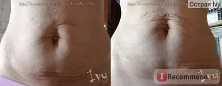 Bandage terhes univerzális (szülés körüli) orto art