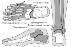 oasele dureri ale cauzelor piciorului