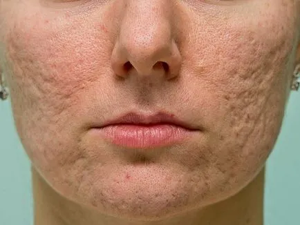 pielea fetei Bumpy cauze si tratament, sfaturi foto si video dermatologi