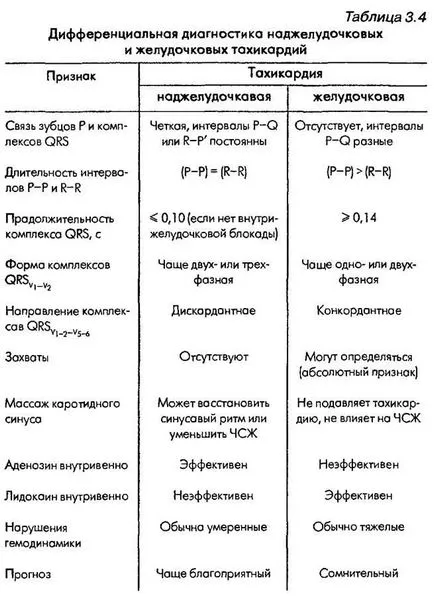 Diagnosticul diferențial de aritmii majore