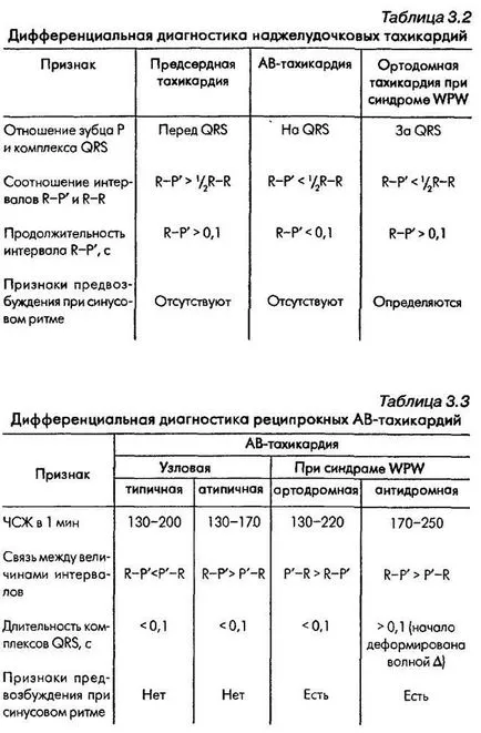 Differenciál diagnózis súlyos ritmuszavarok