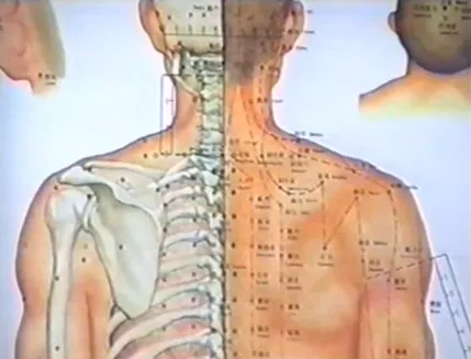 Shuboshi доказано ефективна при лечението на заболявания на гръбначния стълб