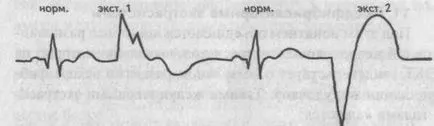 Beats - kardiológus - helyén a betegségek a szív és az erek