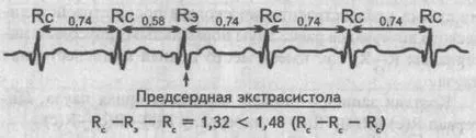 Beats - cardiolog - site-ul de boli ale inimii si vaselor de sange