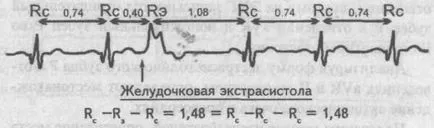 Beats - cardiolog - site-ul de boli ale inimii si vaselor de sange