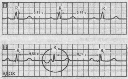 Beats - cardiolog - site-ul de boli ale inimii si vaselor de sange