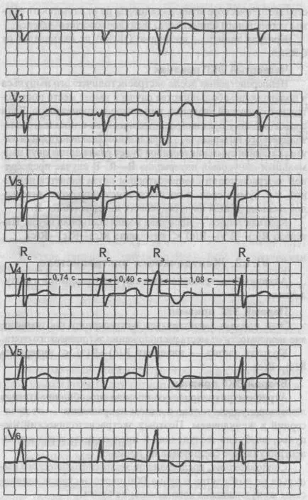 Beats - cardiolog - site-ul de boli ale inimii si vaselor de sange