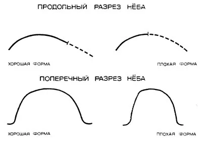 Voce și calitatea acestuia