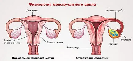 Vertij in timpul menstruatiei - provoacă greață, înainte de menstruație