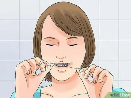 Hogyan fehéríti a fogakat jelenlétében fogászati ​​nadrágtartó