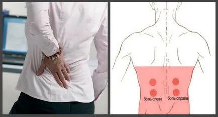 Лумбаго причина за болка, симптоми, лечение и лекарства у дома, упражнения