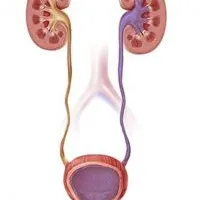 Voiding cystography, stil de viață sănătos, prevenirea, simptomele și tratamentul