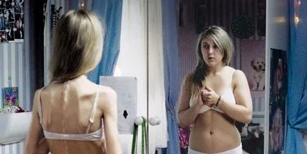 Anorexia nervosa - anorexia kezelésére Moszkva, módszere szerint Vlad fáklya