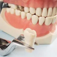 Rögzítése és tömítések fogsor, fogászati ​​kezelés