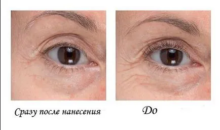Krém a szem körüli ráncok ellen a bőr öregedését