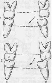 Bazele de diagnostic ocluzale