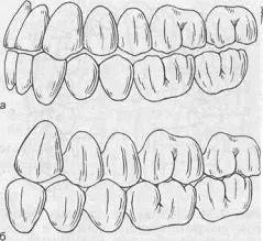 Bazele de diagnostic ocluzale