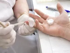 hemostaza primară, etapele hemostază-vasculare plachetare