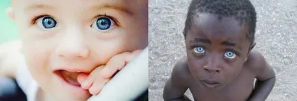 Miért olyan emberek, barna szeme, és vannak kék