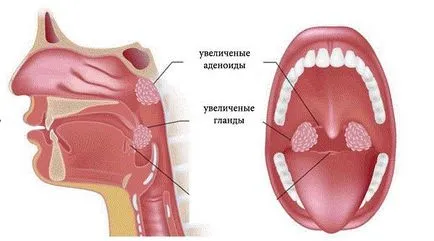 De ce nu respira o nară - provoaca congestie nazala pe de o parte