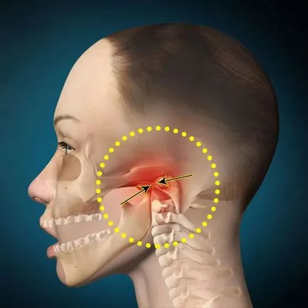 Subluxație al simptomelor maxilarului si tratament