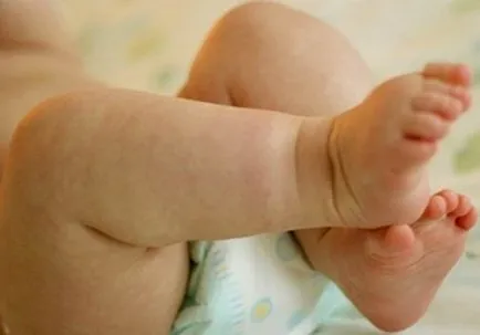 Túlzott izzadás a gyermek okozza és a kezelés hyperhidrosis serdülőknél