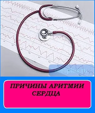 Причини за възникване на сърдечни аритмии