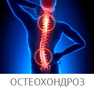 Маточната шийка-торакална остеохондроза - заболяване на гръбнака в гръдния диска, гърдата, фото и видео,