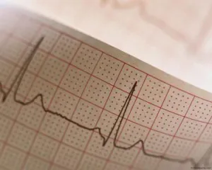 Sinus arrhythmia gyermekeknél és serdülőknél okoz, kezelés, megelőzés