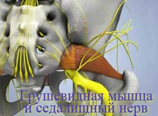 sindromul piriformis, yoga în timpul ciupituri a nervului sciatic cu fotografii