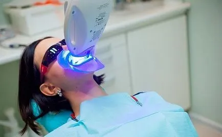 Albirea cu laser și zoom - clinica dentara Dr. Granova