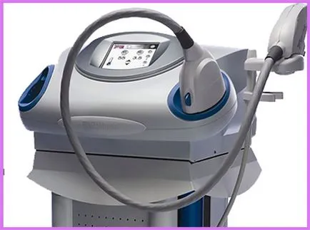 Sistemul laser Palomar StarLux 500 - standardul de aur - cu laser intinerire