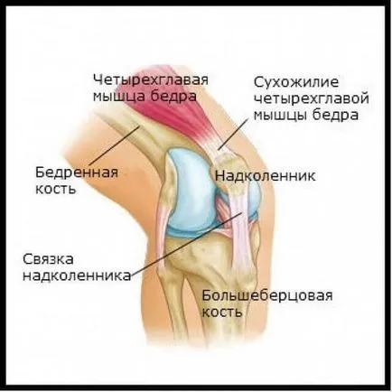 Kezelése deformáló arthrosis a térd - okai és megelőzése