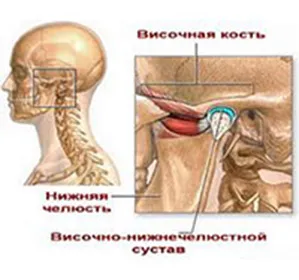 Zavar és subluxation a TMJ kezelés okokból - az orvosi enciklopédia