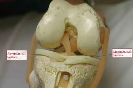 Restaurarea și reabilitarea după îndepărtarea meniscului articulației genunchiului, efectele intervenției chirurgicale