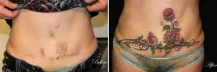 21 fotografii de tatuaje care au ajutat cu maiestrie ascunde cicatrici si alte imperfectiuni ale pielii