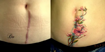 21 kép tetoválás, hogy segített művészien álcázni hegek és egyéb bőrhibák