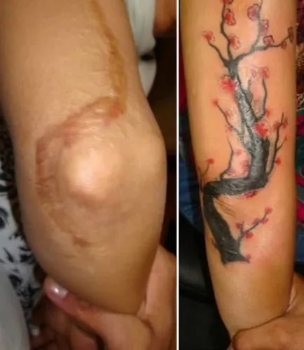 21 fotografii de tatuaje care au ajutat cu maiestrie ascunde cicatrici si alte imperfectiuni ale pielii