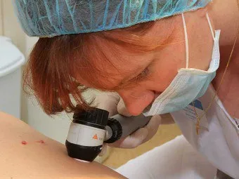 Dermoscopy кожни лезии - каква е процедурата се извършва под формата на